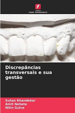 Discrepâncias transversais e sua gestão