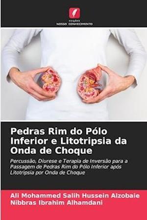 Pedras Rim do Pólo Inferior e Litotripsia da Onda de Choque