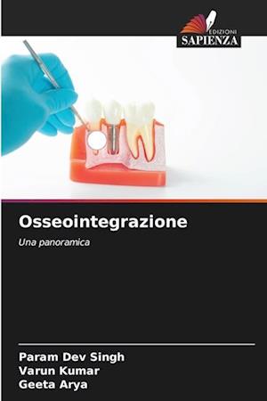 Osseointegrazione