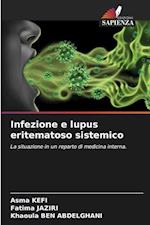 Infezione e lupus eritematoso sistemico