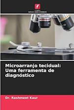 Microarranjo tecidual: Uma ferramenta de diagnóstico