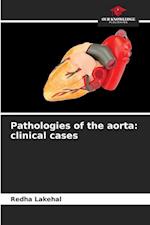 Pathologies of the aorta: clinical cases