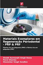 Materiais Exemplares em Regeneração Periodontal - PRP & PRF