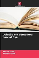 Oclusão em dentadura parcial fixa