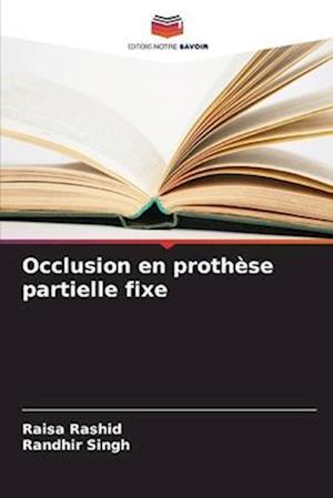 Occlusion en prothèse partielle fixe