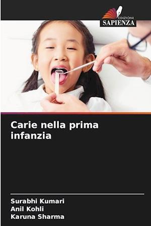 Carie nella prima infanzia