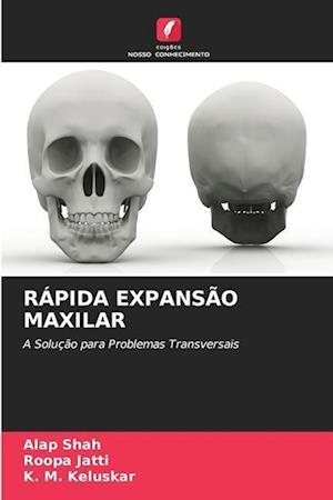 RÁPIDA EXPANSÃO MAXILAR