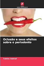 Oclusão e seus efeitos sobre o periodonto