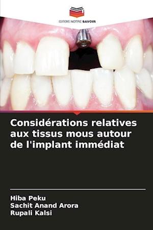 Considérations relatives aux tissus mous autour de l'implant immédiat