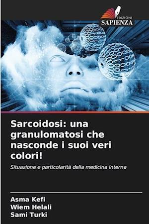 Sarcoidosi: una granulomatosi che nasconde i suoi veri colori!