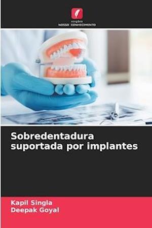 Sobredentadura suportada por implantes