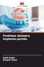 Prothèse dentaire implanto-portée