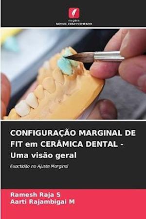 CONFIGURAÇÃO MARGINAL DE FIT em CERÂMICA DENTAL - Uma visão geral