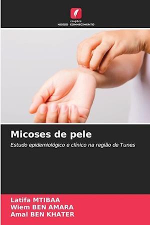 Micoses de pele