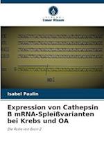 Expression von Cathepsin B mRNA-Spleißvarianten bei Krebs und OA