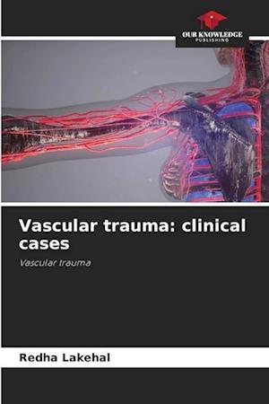 Vascular trauma: clinical cases