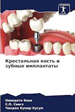 Krestal'naq kost' i zubnye implantaty