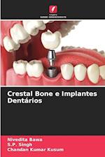 Crestal Bone e Implantes Dentários