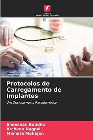 Protocolos de Carregamento de Implantes