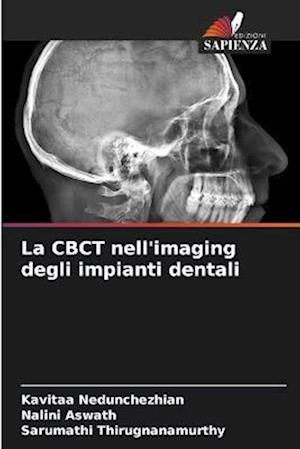La CBCT nell'imaging degli impianti dentali