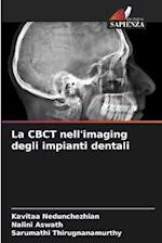 La CBCT nell'imaging degli impianti dentali