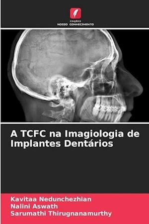 A TCFC na Imagiologia de Implantes Dentários