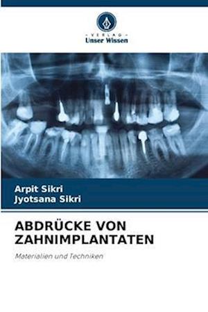 ABDRÜCKE VON ZAHNIMPLANTATEN