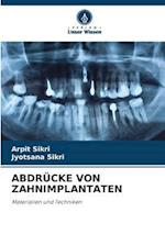 ABDRÜCKE VON ZAHNIMPLANTATEN