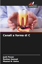 Canali a forma di C