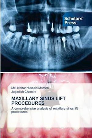 MAXILLARY SINUS LIFT PROCEDURES