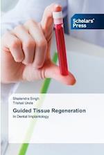 Guided Tissue Regeneration