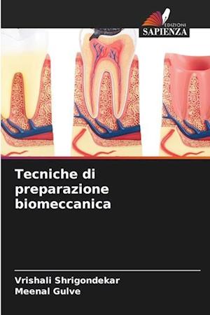 Tecniche di preparazione biomeccanica