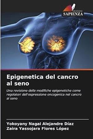 Epigenetica del cancro al seno