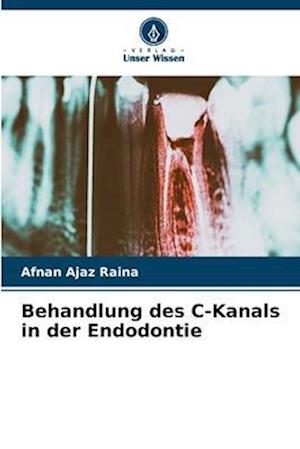 Behandlung des C-Kanals in der Endodontie
