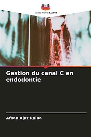 Gestion du canal C en endodontie