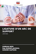 LIGATURE D'UN ARC DE SUPPORT