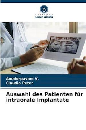 Auswahl des Patienten für intraorale Implantate