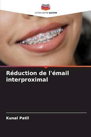 Réduction de l'émail interproximal