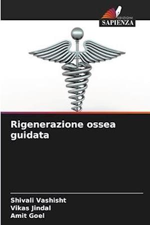 Rigenerazione ossea guidata