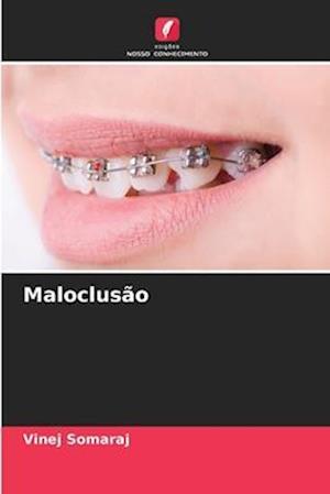 Maloclusão