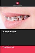 Maloclusão