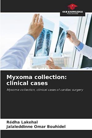 Myxoma collection: clinical cases