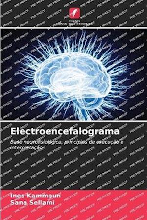 Electroencefalograma