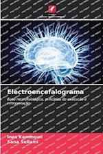 Electroencefalograma