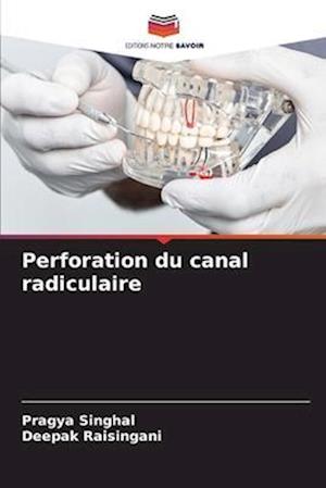 Perforation du canal radiculaire