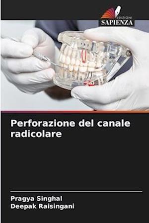 Perforazione del canale radicolare