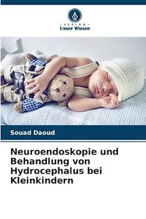 Neuroendoskopie und Behandlung von Hydrocephalus bei Kleinkindern