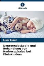 Neuroendoskopie und Behandlung von Hydrocephalus bei Kleinkindern