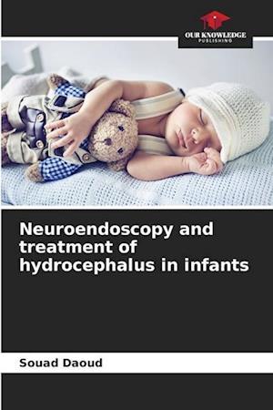 Neuroendoscopy and treatment of hydrocephalus in infants