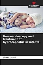 Neuroendoscopy and treatment of hydrocephalus in infants